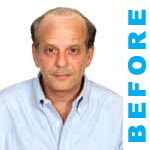 True Hair - Hair Transplants and Hair Replacement Toronto